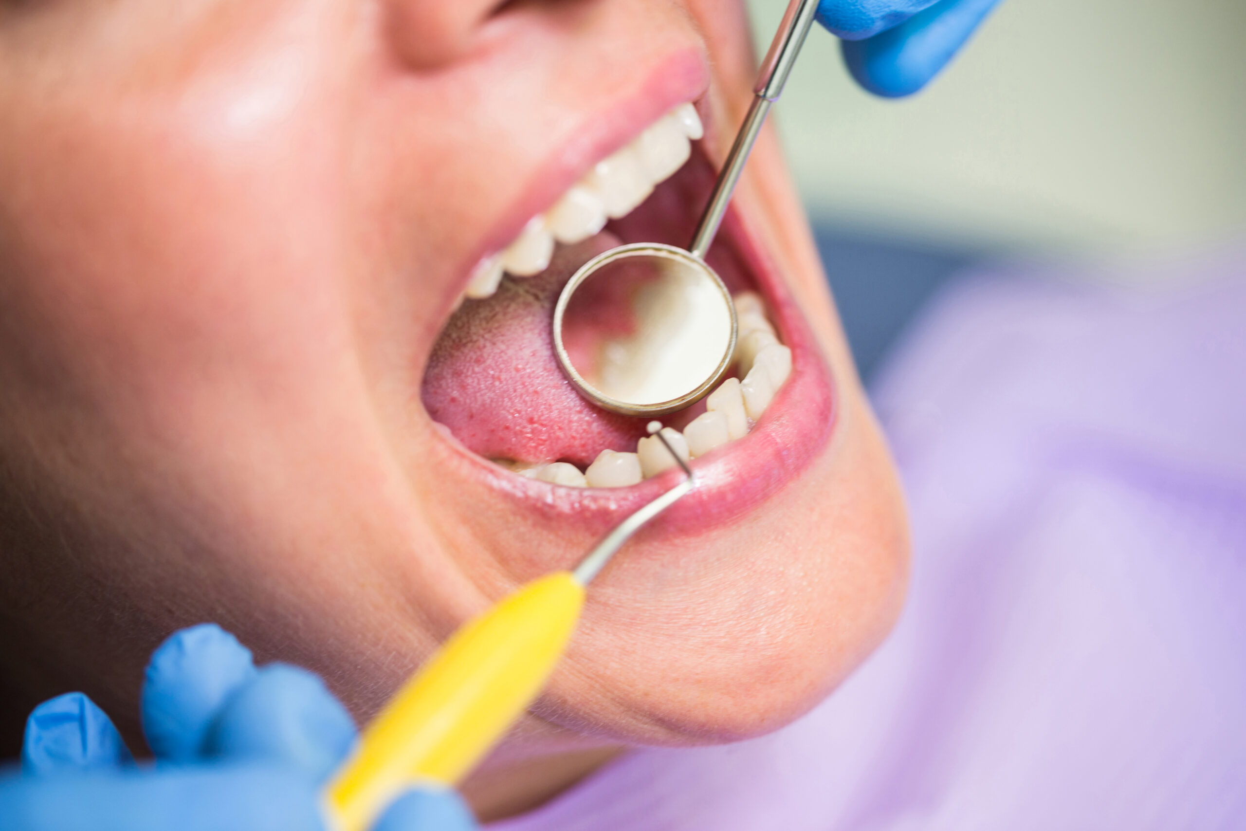 Close-up of dentist examining female patient teeth